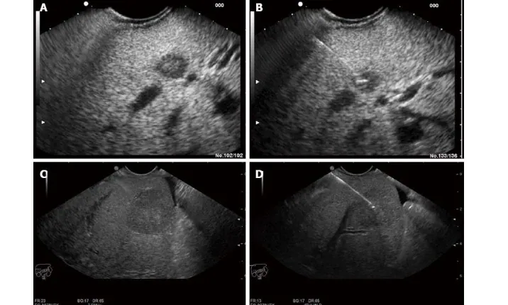 Diagnostic Abdominal Ultrasound & FibroScan training